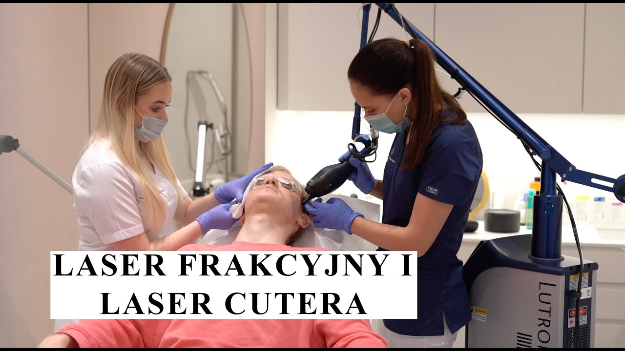 Laseroterapia blizn po trądziku