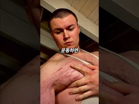 운동하면 피부가 이렇게 됩니다 <strong>ㅠ</strong>