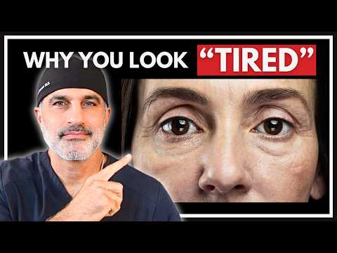 Why Your Eyes Look Tired And How To Fix It 