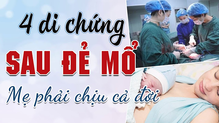 1 ca mổ đẻ mất bao nhiêu thời gian năm 2024