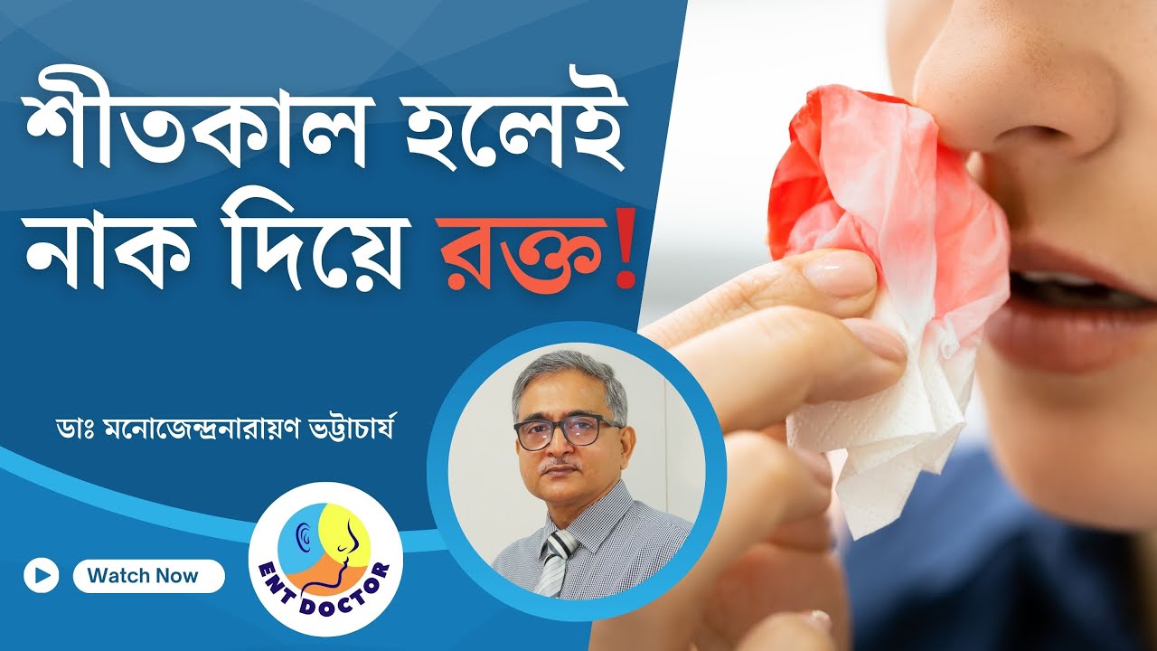Nosebleeds in Winter Season: শীতকালে নাক দিয়ে রক্তপাত