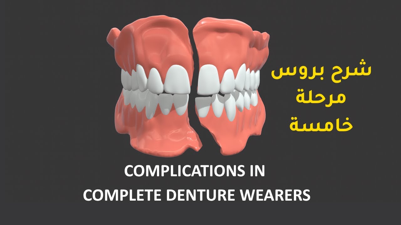 COMPLICATIONS IN COMPLETE DENTURE WEARERS - شرح بروس مرحلة خامسة