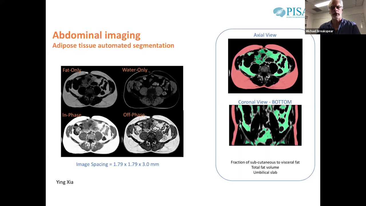 OHBM Australia Chapter Event-- Big Neuroscience Data: Opportunities and Challenges