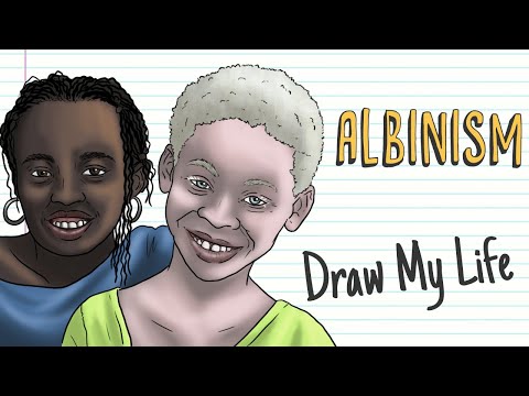 ALBINISM | Draw My Life