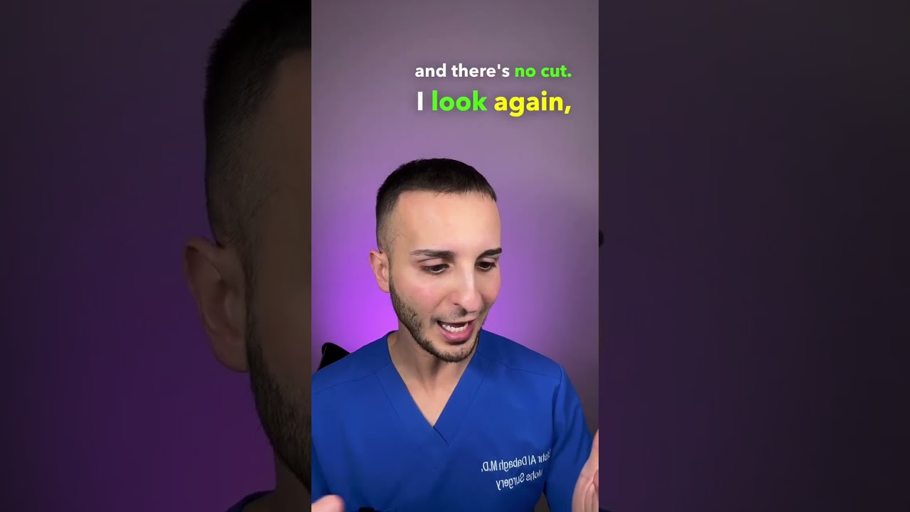 Hair Splinters- be warned! #hair #haircare #hairstyle #hairsplinter