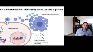 “Systemic inflammation and other unexpected surprises in the host response to SARS-CoV-2”.