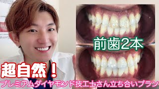 超自然プレミアムダイヤモンドセラミック矯正治療技工士さん立ち合いプラン料金もお伝え