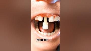 Que faire si une dent tombe 😳