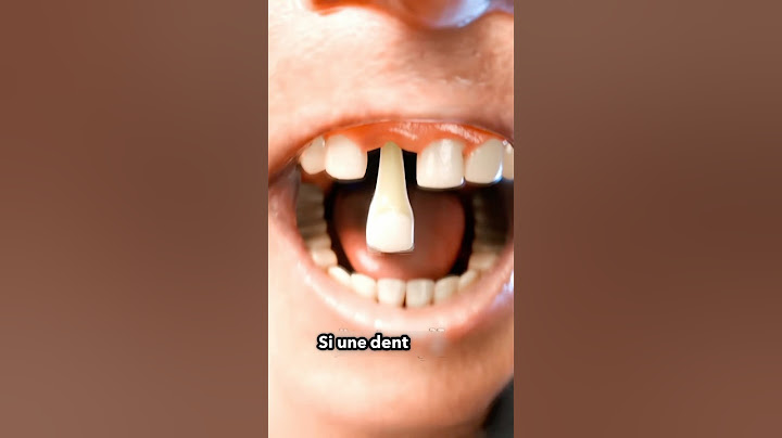 Que faire si une dent tombe 😳
