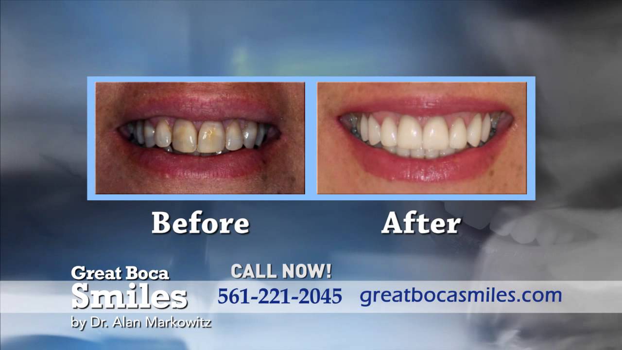 Boca Raton's Best Dentist Dr. Alan Markowitz of Great Boca Smiles