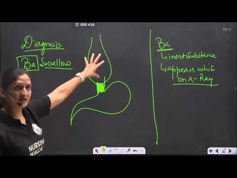 53  428 Digestive System 05 Esophageal Diseases Part 2 🔥