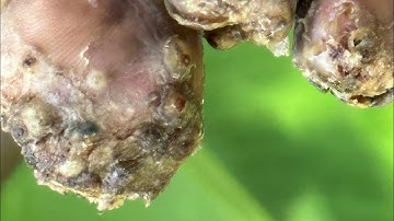 Jigger digging Daniel Mokhae