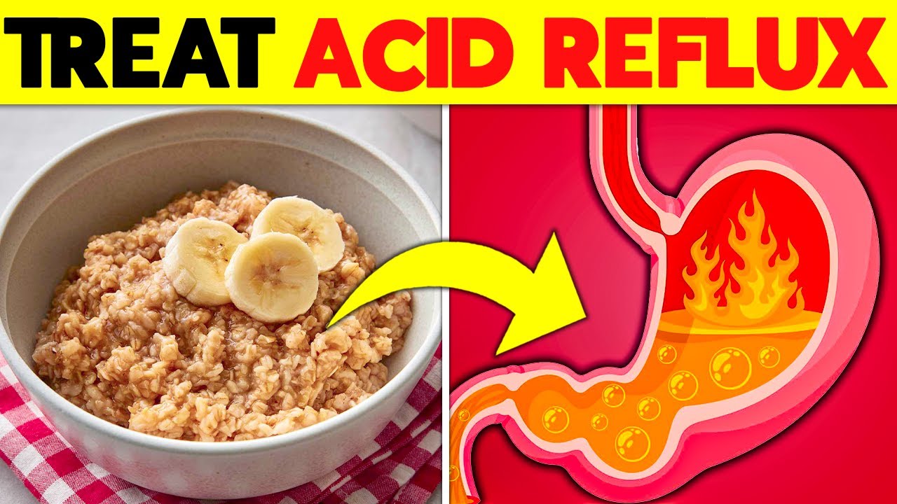 10 Foods That Help ACID REFLUX Go Away! YouTube