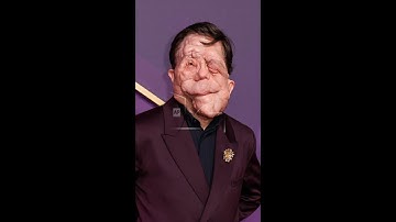 Adam Pearson details intense screen fight with Sebastian Stan in 