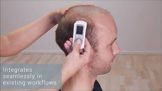 Easy Angle - Easier and more accurate measurements mp4