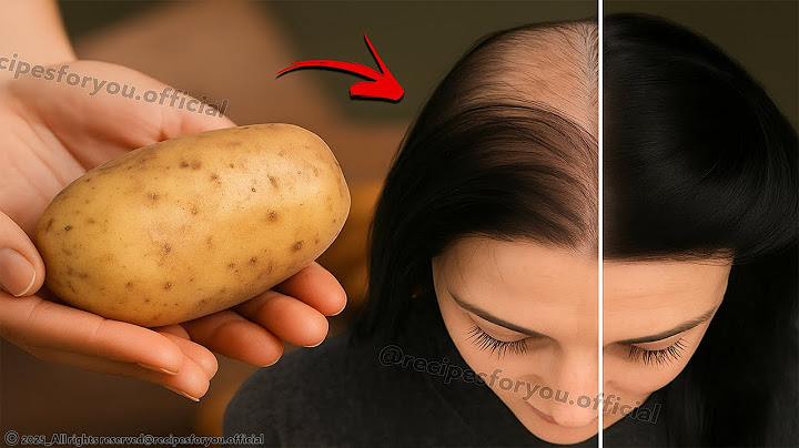 🌱 Hair Grows Like Crazy & Stops Falling Out! 💥 The Most Powerful Natural Recipes! Hair Growth Tips 🌿