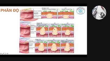 CẬP NHẬT CÁC HƯỚNG DẪN CHẨN ĐOÁN VÀ ĐIỀU TRỊ UNG THƯ TRỰC TRÀNG | ThS. BS. TRẦN VŨ ĐỨC