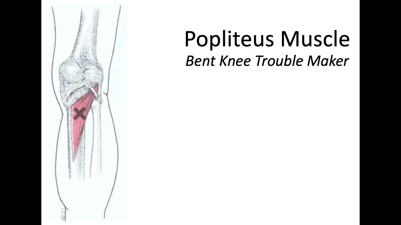 Popliteus Muscle – Bent Knee Trouble Maker | Physiotherapy Presentation