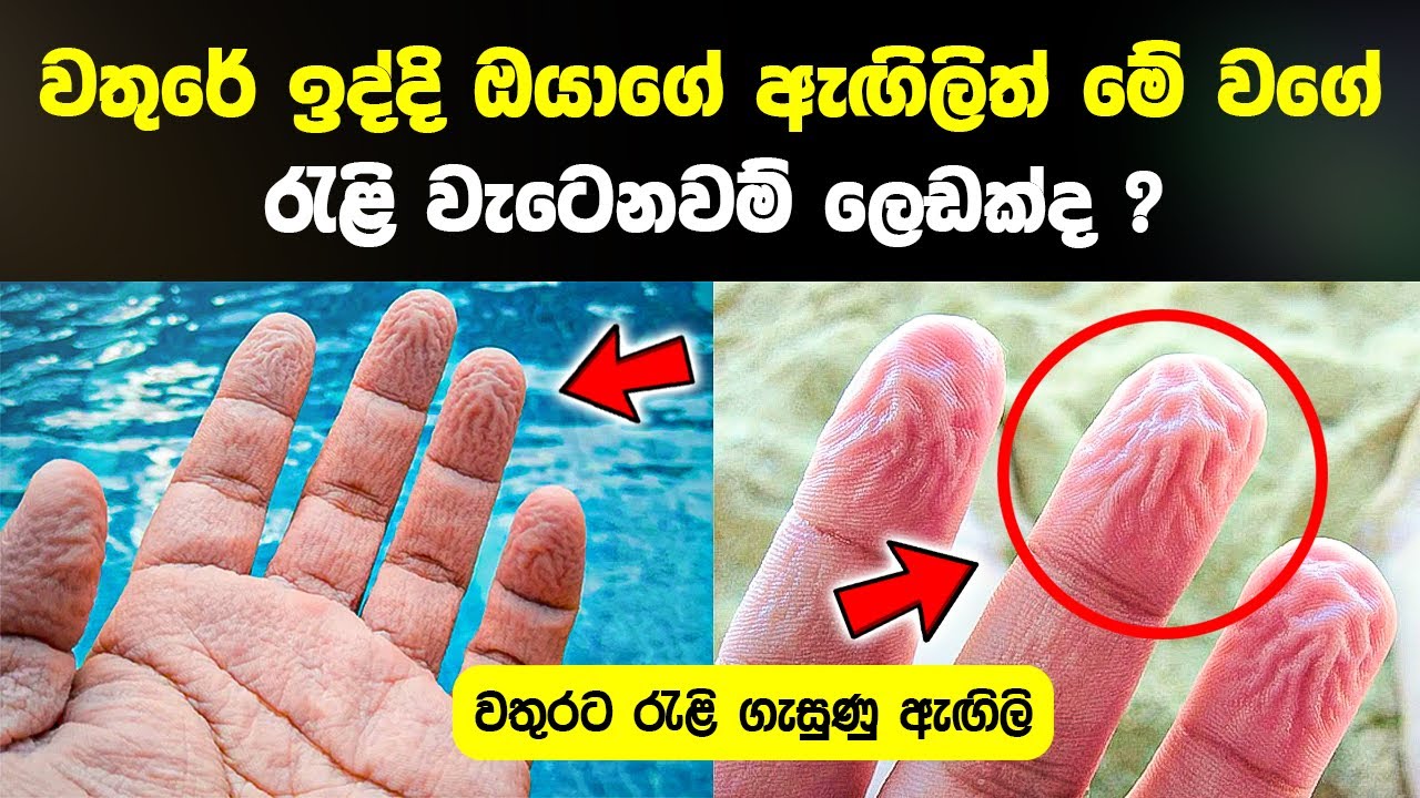 වතුරට ඇගිලි රැළි ගැසෙන්නේ ලෙඩකටද ? Why do the Fingers Ripple in the Water Health Tips