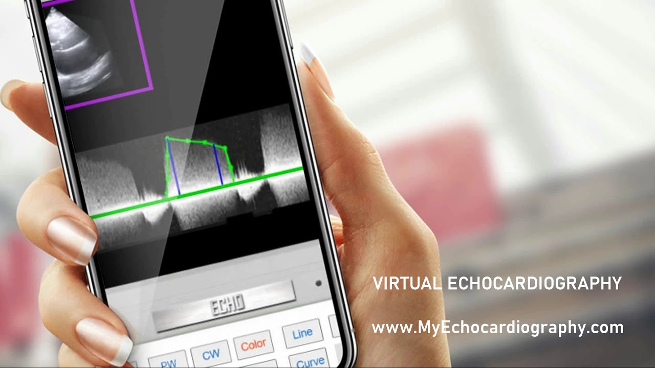 Apical 4 Chamber View - YouTube