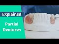 Partial dentures & false teeth explained