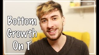Ftm Bottom Growth Do You Grow A Pnis?