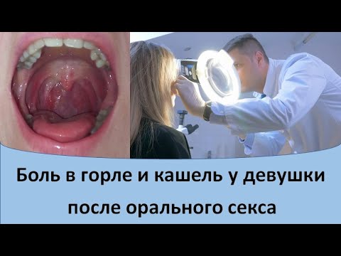 Боль в горле и кашель у девушки после орального секса