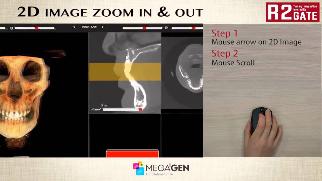 2D image zoom in & out - YouTube