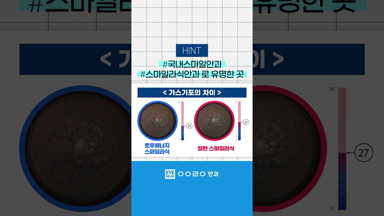 [Айриум Нүдний Эмнэлэг] #СмайлЛасик нүдний эмнэлэг хайж байхдаа заавал очих ёстой #Ганнам Нүдний Эмнэлэг нь аль нь вэ? 🤔 #shorts 🔼🔼 Видеоноос үзээрэй!!