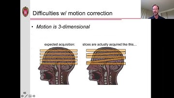 MRI Pulse Sequences - Part 5: Artifacts