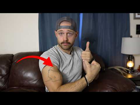 Full Proximal Bicep Tear Recovery WITHOUT Surgery