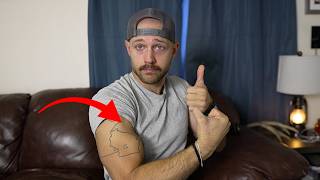 Full Proximal Bicep Tear Recovery Without Surgery