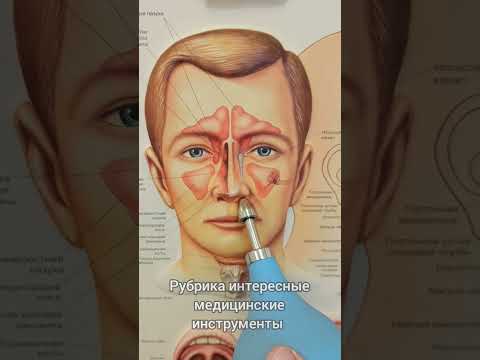 как продувает уши лор врач #здоровье #врач #дети #лор #медицина #уши