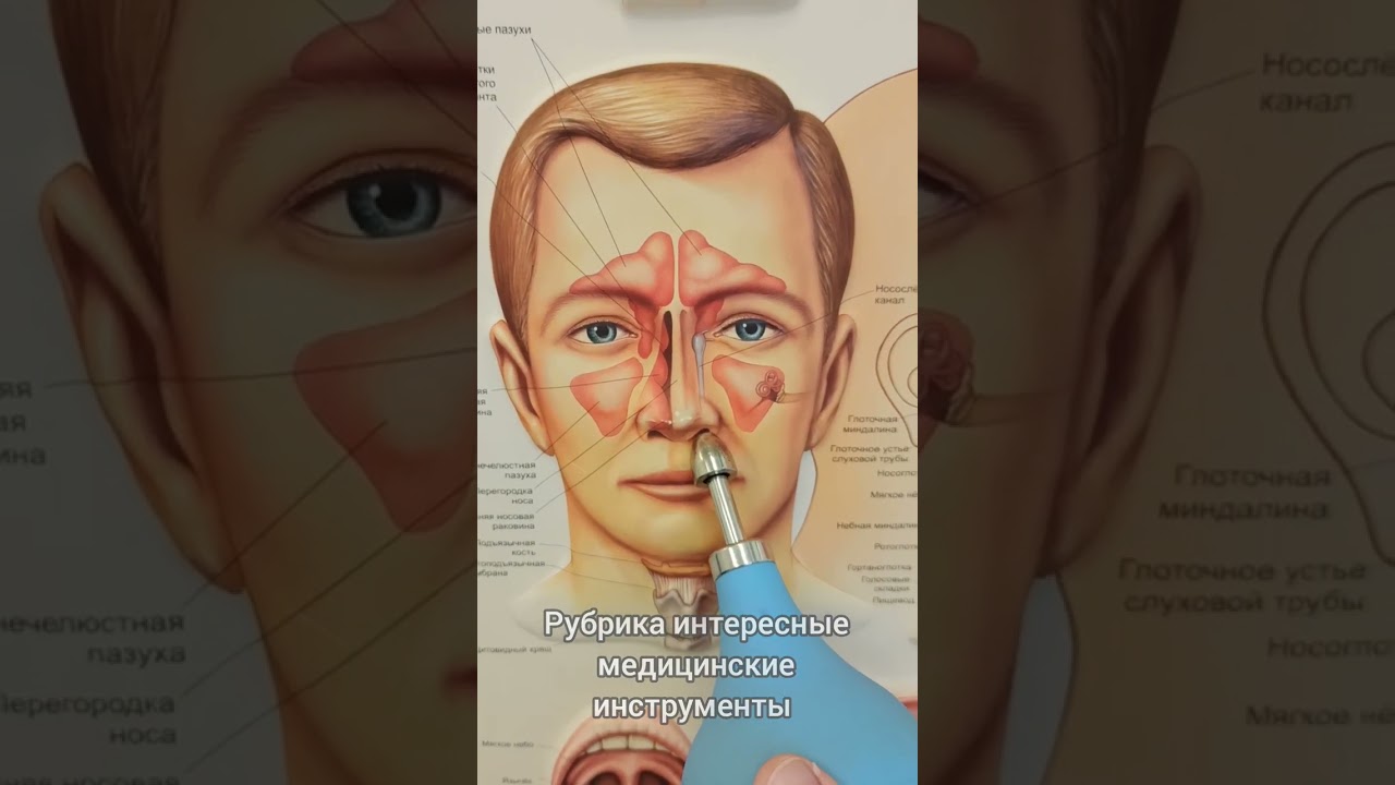 как продувает уши лор врач #здоровье #врач #дети #лор #медицина #уши