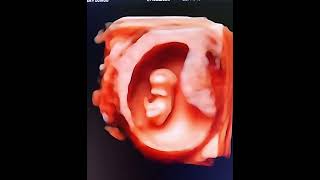 10 Haftalık Bebek - 4 Boyutlu Canlı Hd Ultrason Görüntüsü