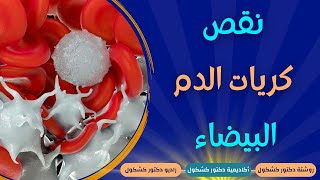 اسباب نقص كريات الدم البيضاء وعلاجها