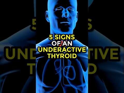 5 Signs Of