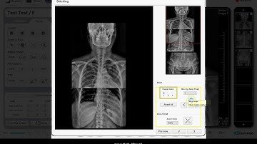 ExamVue DR Medical Imaging Software | Image Stitching