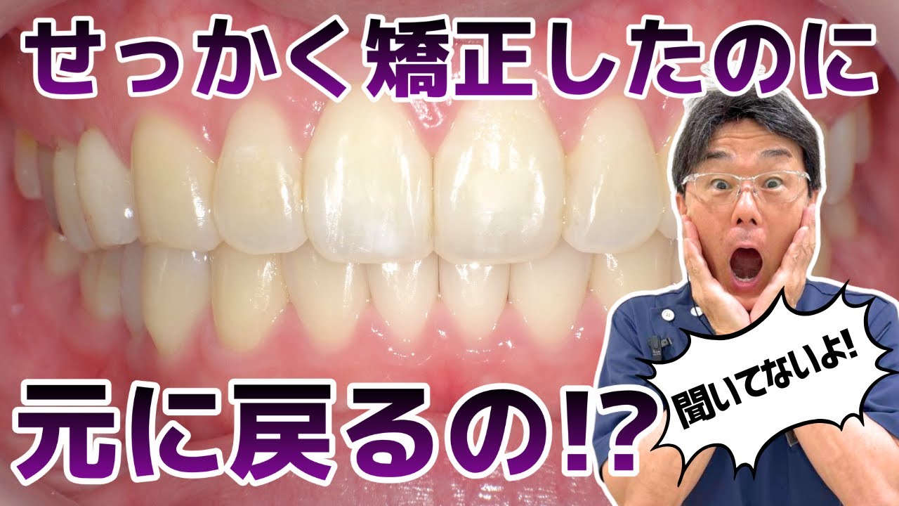 【矯正後の後戻り】せっかく矯正して綺麗な歯並びになったのに注意事項を守らないと元のように戻ってしまうのを知っていますか？「後戻りを防ぐためにどうするか」を細かく解説していきます。