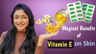 इसे इस्तेमाल करोगे तो मिलेगा Instant Buttery Soft Skin ✨| Uses of Vitamin E Oil