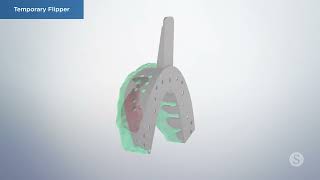 What is Dental Flipper | Temporary Tooth Flipper