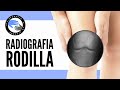 Dolor de rodilla, ¿cuando es necesaria una radiografia?