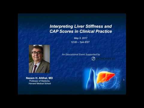 Liver Stiffness Chart