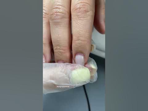 Почему нельзя делать толстое покрытие. Отслойки возле кутикулы ...
