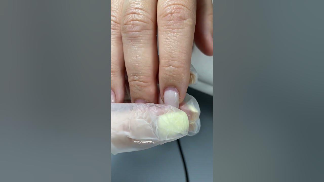Почему нельзя делать толстое покрытие. Отслойки возле кутикулы ...