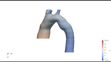 Pressure field of an aortic pulsatile flow with OpenFOAM
