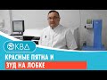 🙁 Красные пятна и зуд на лобке. Клинический случай №841