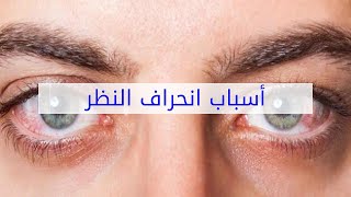 أسباب انحراف النظر