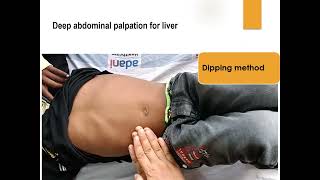Liver Palpation Methods I Deep Abdominal Palpation for Liver | Pediatrics
