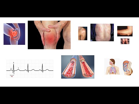 Video: CardioActive Vitamīni Sirdij - Lietošanas Instrukcijas, Atsauksmes, Cena